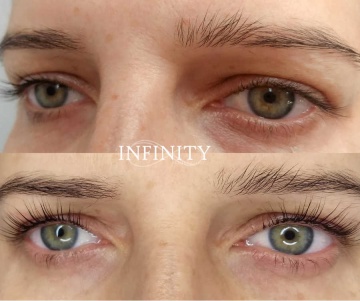 Infinity Beauty Clinic
