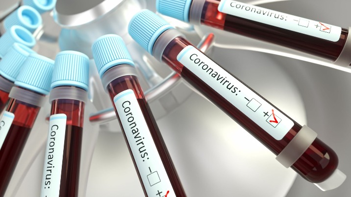 Ponad pół tysiąca zakażonych koronawirusem w Wielkopolsce