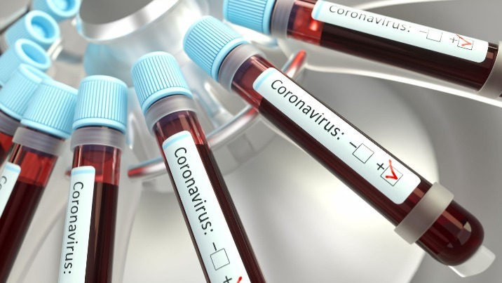 Koronawirus. 23 nowe przypadki zakażeń w regionie konińskim